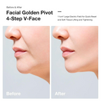 VYRA Slimax Microcurrent Anti-aging Device